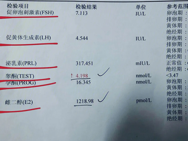 雌激素能促进内膜增生