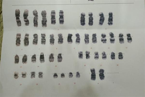 染色体检查报告终生有效