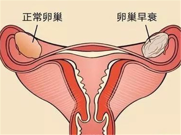 冷冻卵巢组织费用五万元以内