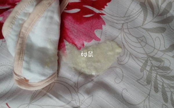 吐奶像豆腐渣一样是正常的