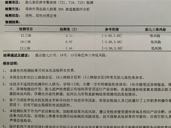 无创dna检查报告单